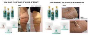 il trattamento corpo ispirato al microneedling… senza aghi